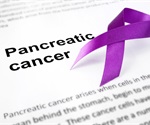 Research sheds light on the early cellular events that give rise to pancreatic cancer