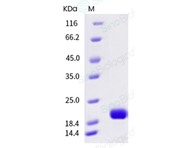 IL-6 Protein, Recombinant, Human from Sino Biological