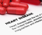 One-third of adults in the U.S. with Type 2 diabetes may have symptomless cardiovascular disease