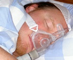 Study explores the link between sleep apnea and brain volume