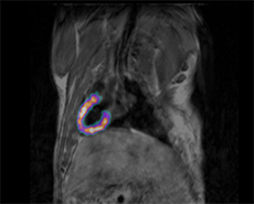 The Revolution in Preclinical PET - Continuous Crystal and Smart Electronics to Achieve Full Field Accuracy