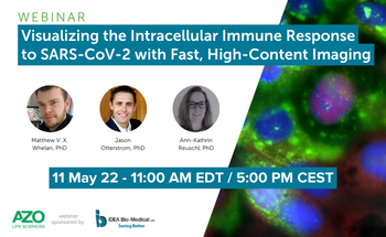 Visualizing the Intracellular Immune Response to SARS-CoV-2 with Fast, High-Content Imaging